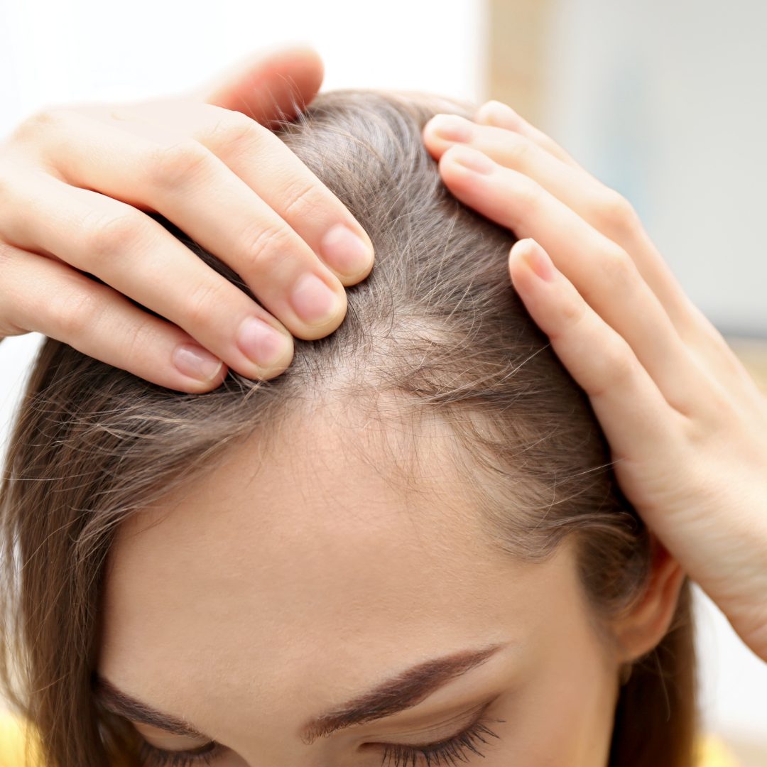 PRF For Hair Loss
