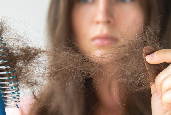 PRF For Hair Loss