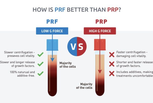 PRF For Hair Loss